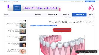 لقطة شاشة لموقع زراعة الاسنان في مصر
بتاريخ 26/02/2020
بواسطة دليل مواقع إنسااي